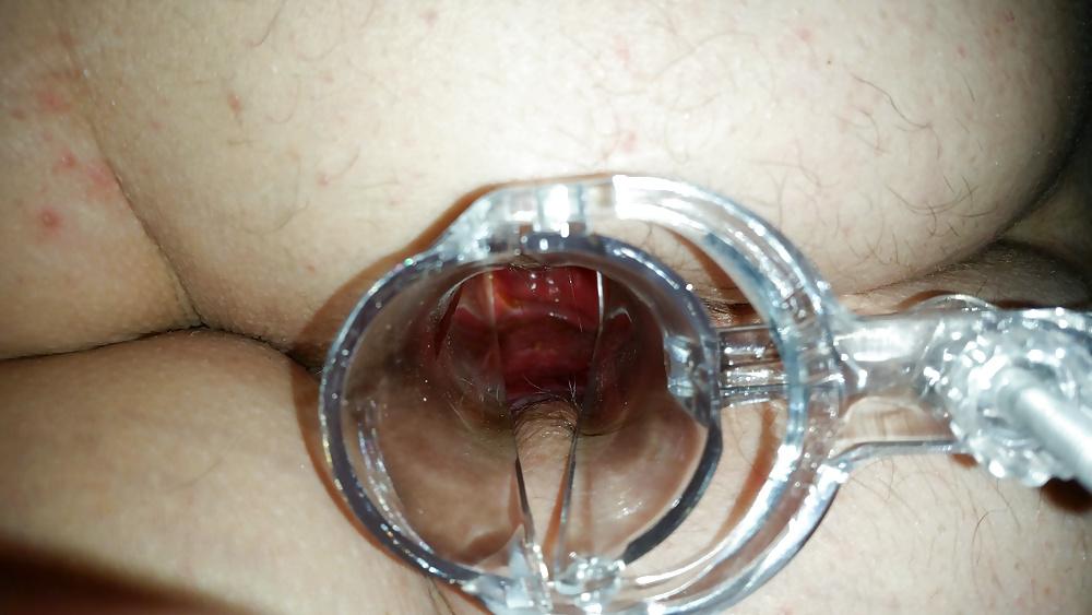 13P Speculum in wifes ass