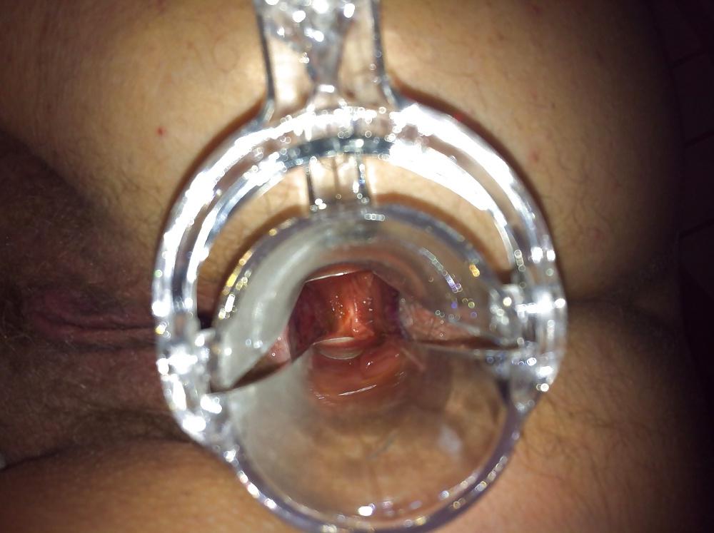 13P Speculum in wifes ass