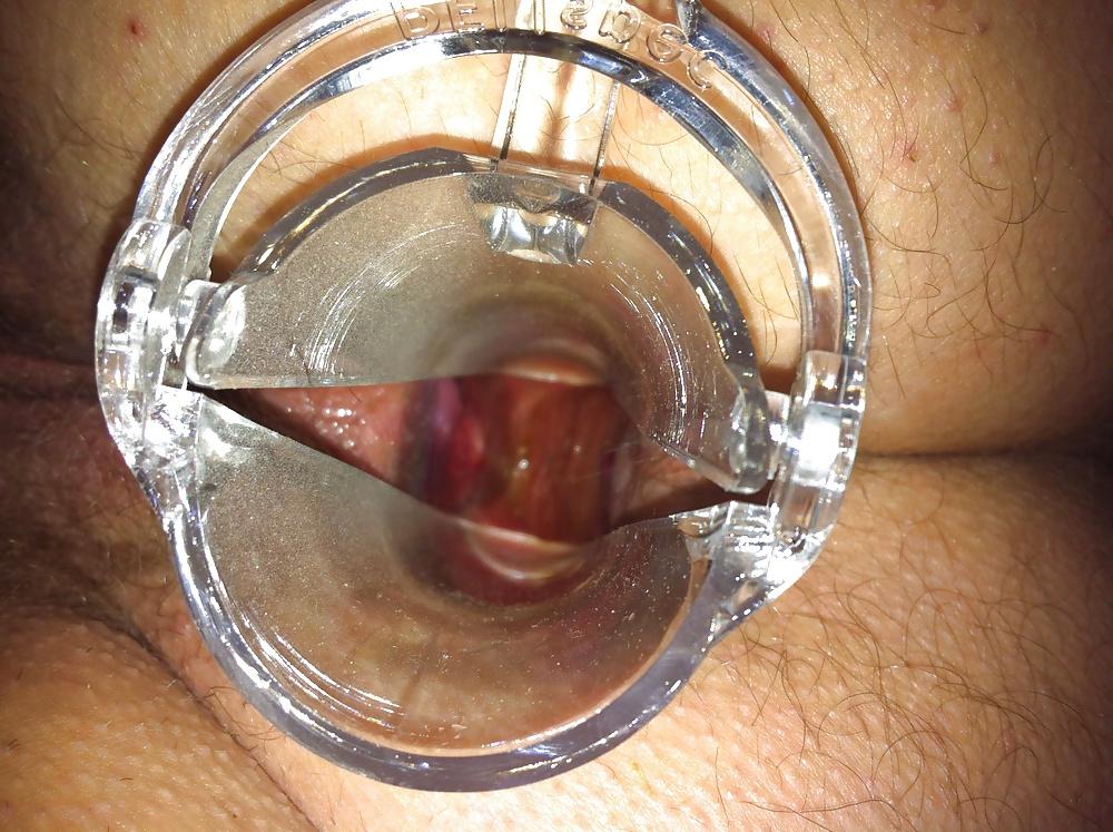 13P Speculum in wifes ass