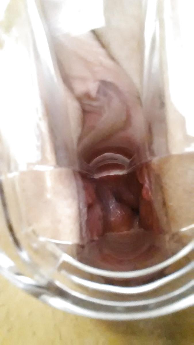 7P Speculum Fun