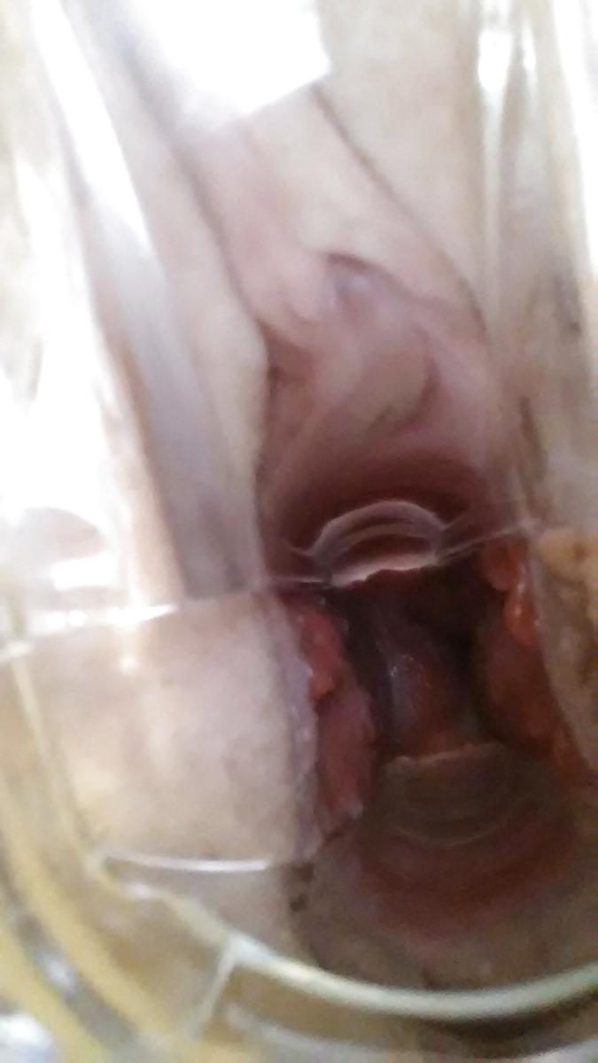 7P Speculum Fun