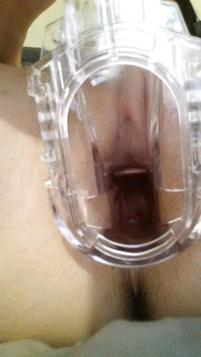 7P Speculum Fun