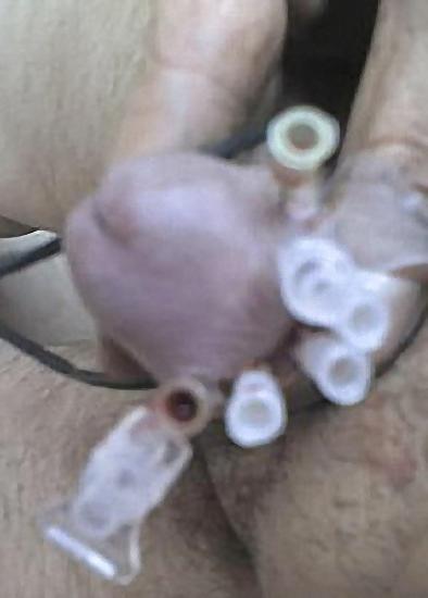 17P Meine CBT Kloeten