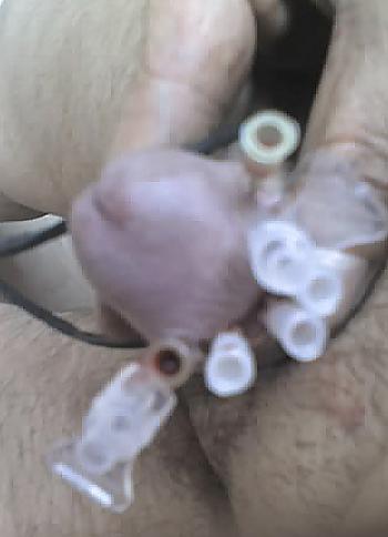 17P Meine CBT Kloeten