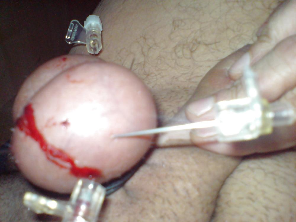 17P Meine CBT Kloeten
