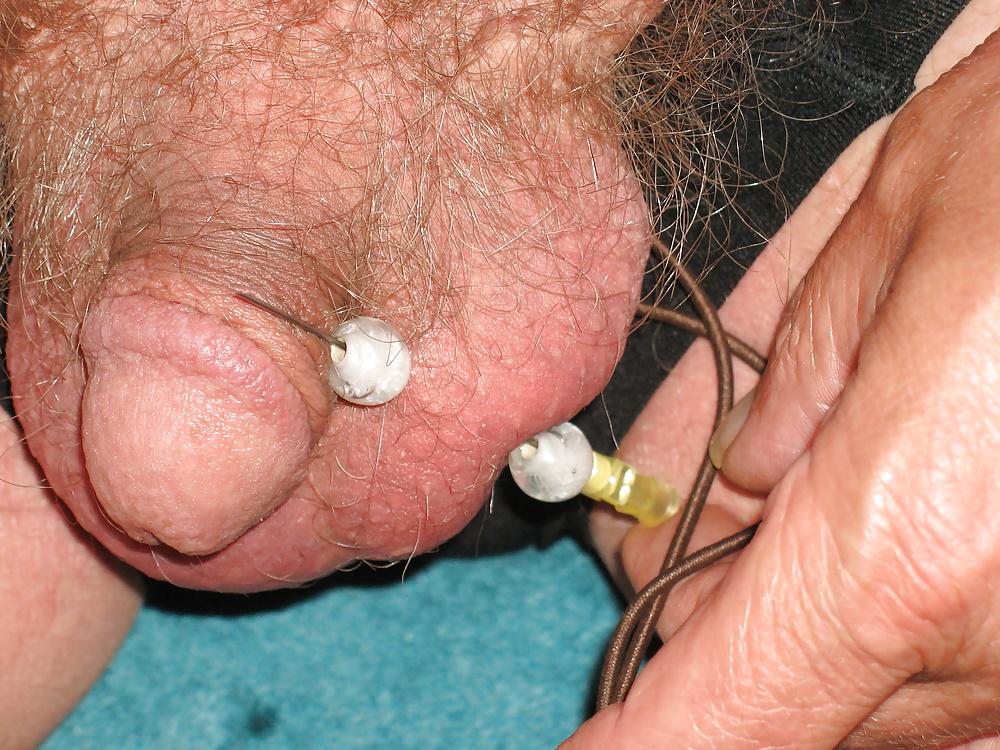 11P My CBT