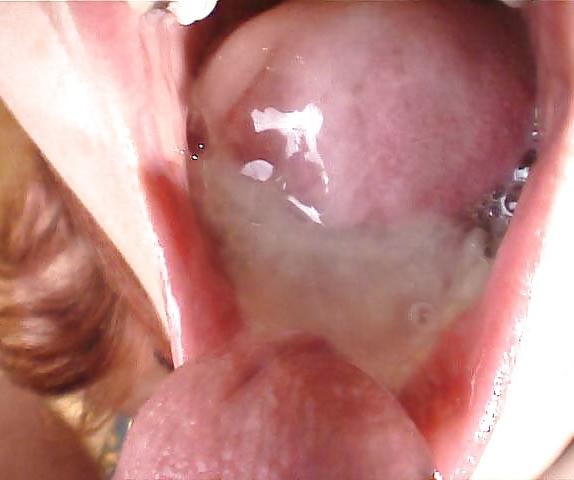 24P Sperm attack 9