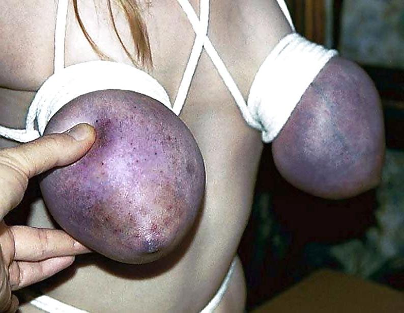 25P Breast Bondage #7