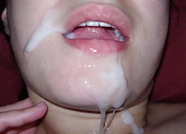 23P Sperm attack 8
