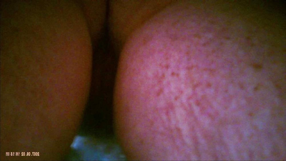 7P The other Nurse of the ward caught upskirt pantiesless