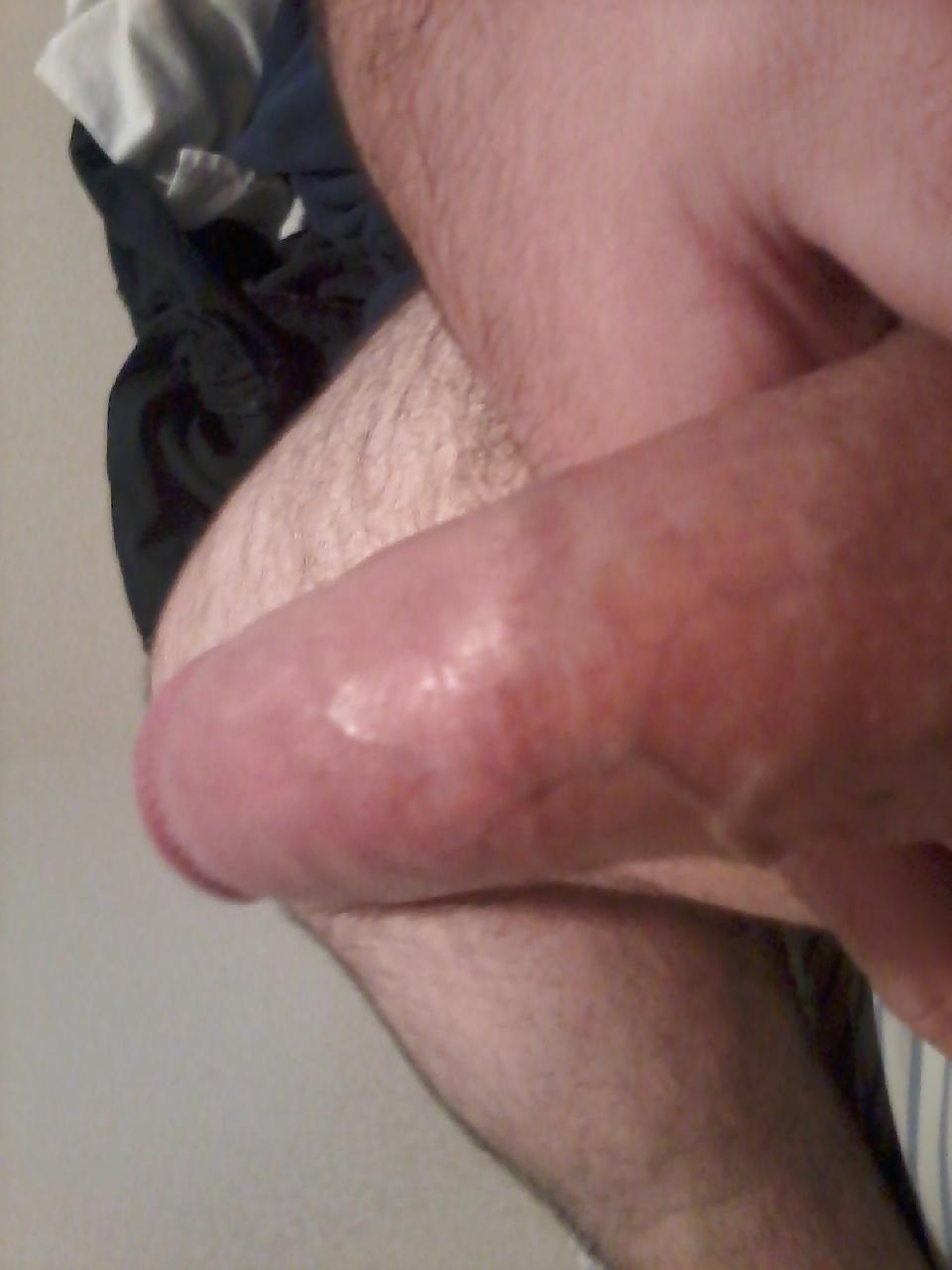 7P Pics on my phone