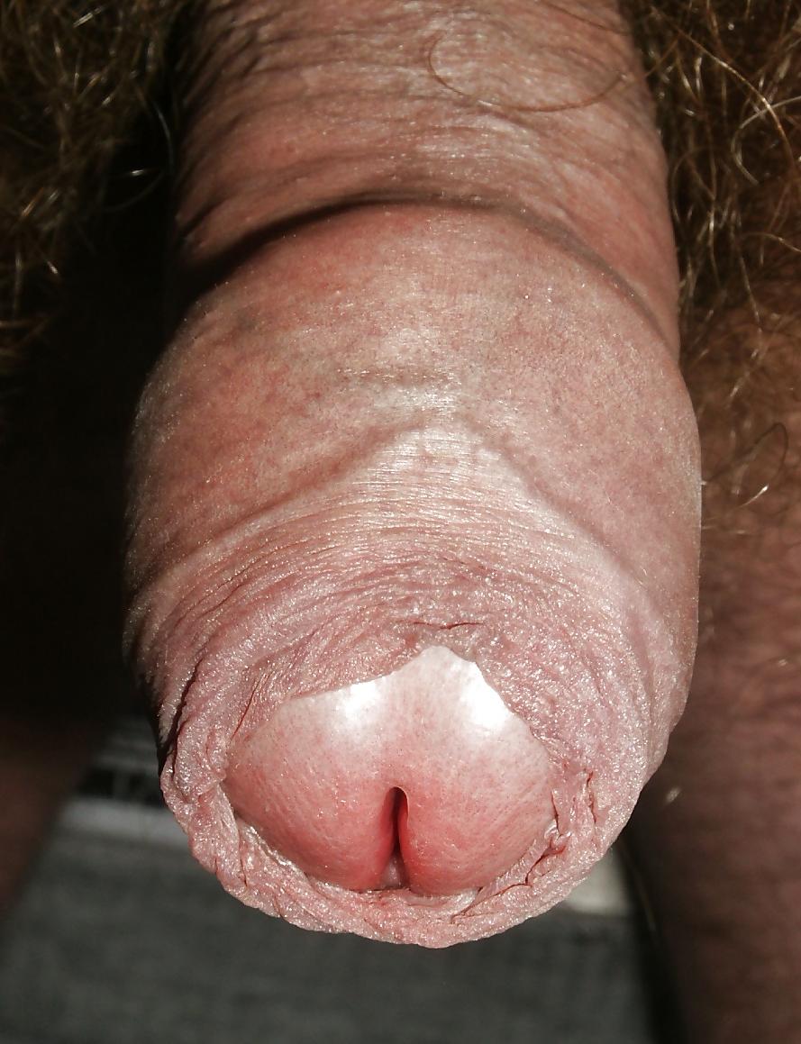11P My Uncut CloseUp