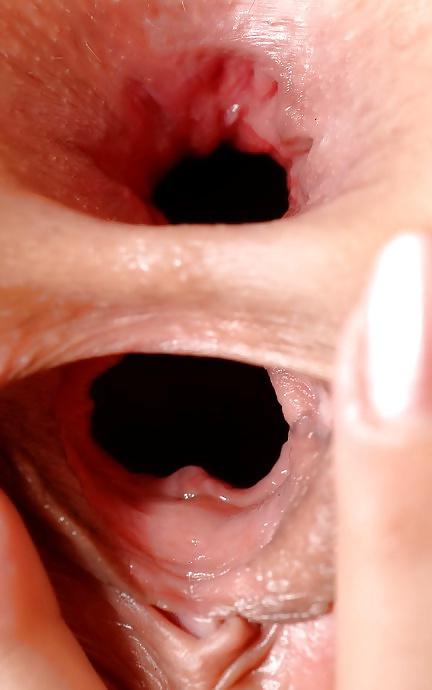 12P Great Gaping Holes