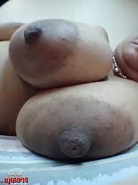 12P Huge areolas