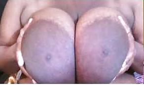 12P Huge areolas