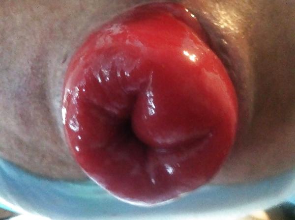 6P Nice prolapse hole