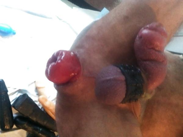 6P Nice prolapse hole