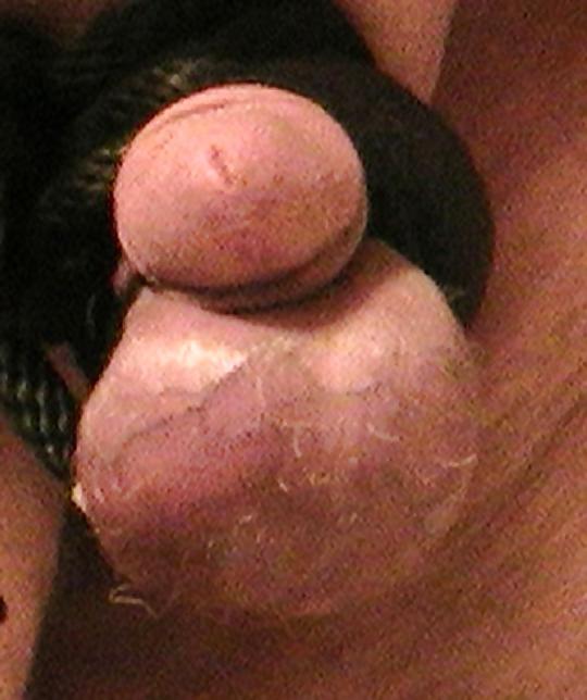 9P CBT