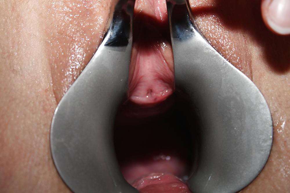 8P Speculum