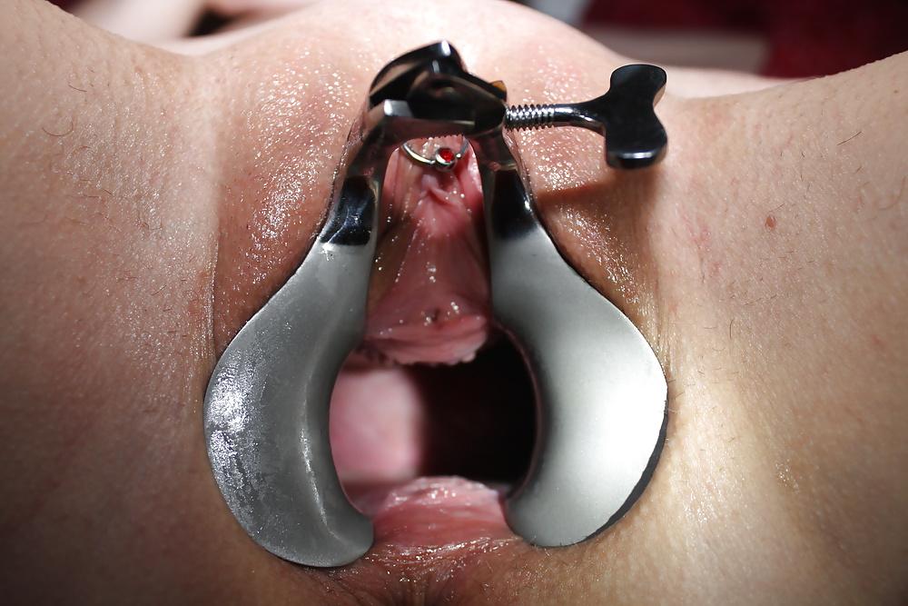 8P Speculum