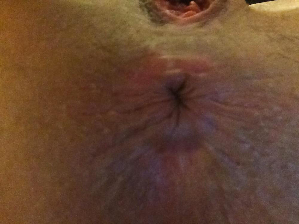 25P Hope Solo Leaked Nudes