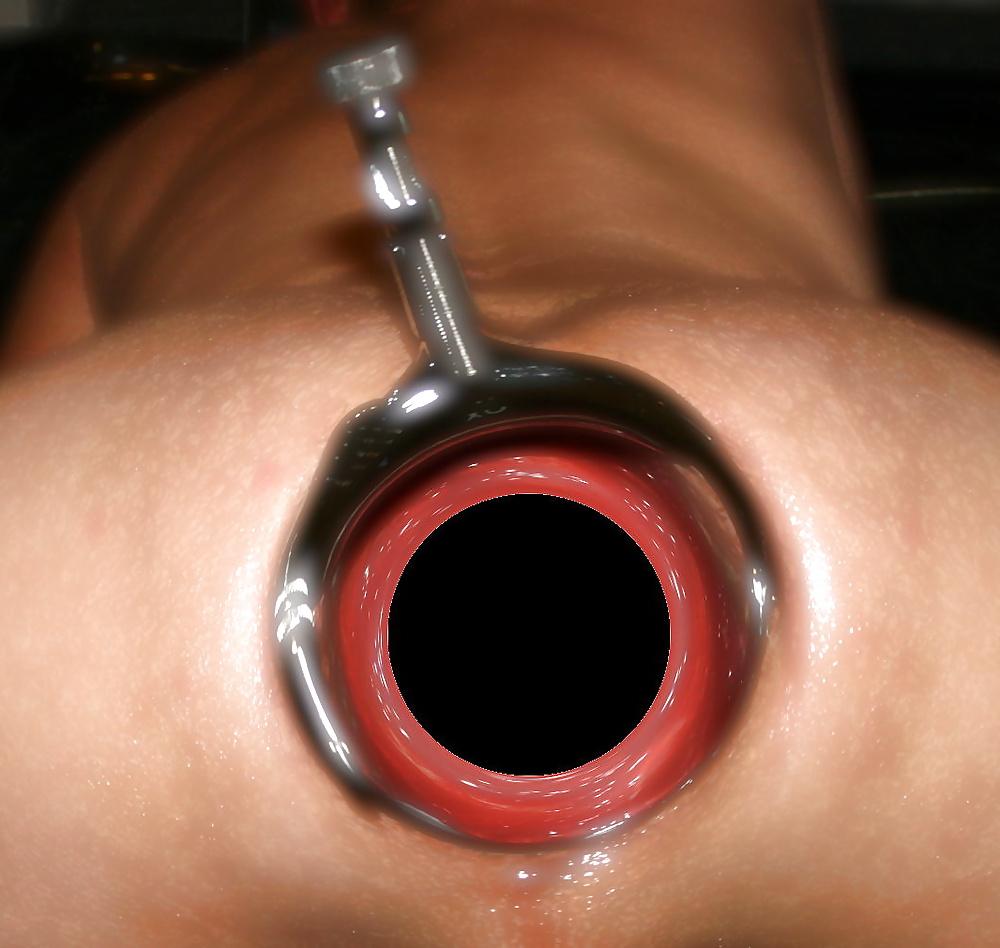4P XO Speculum
