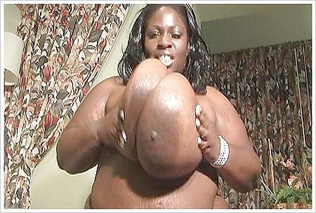 10P More Massive Mammaries