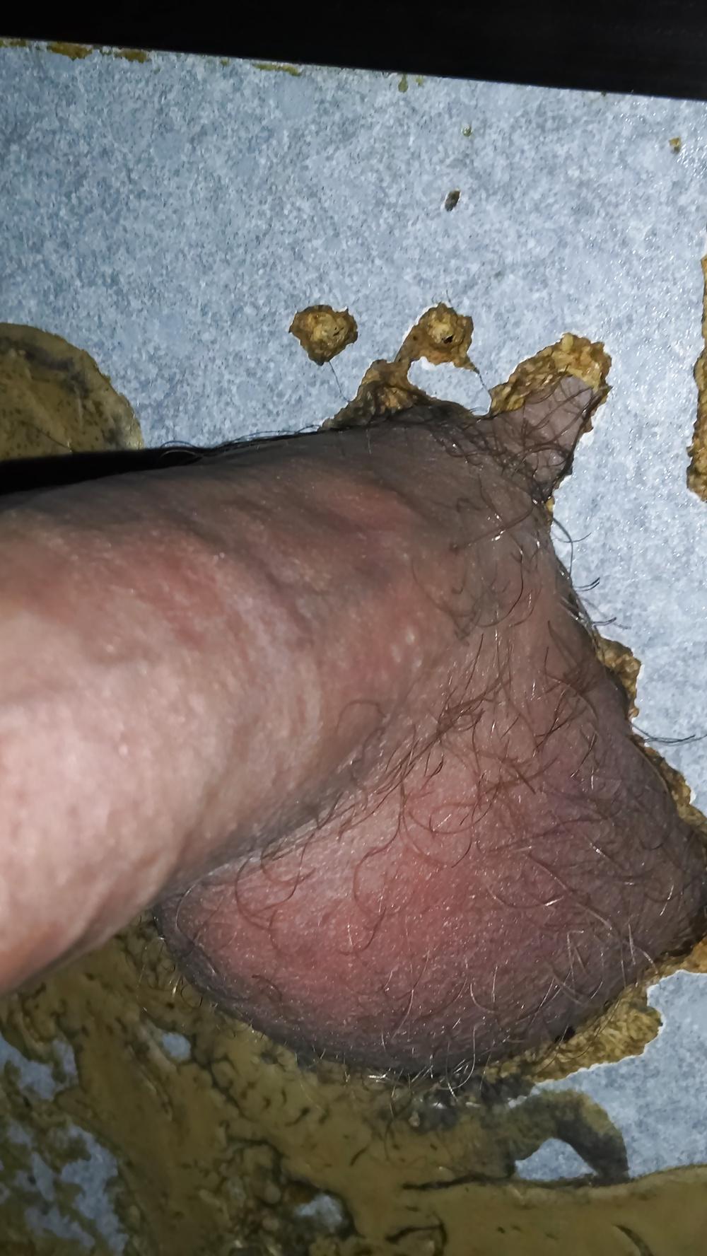 11P Glory Hole