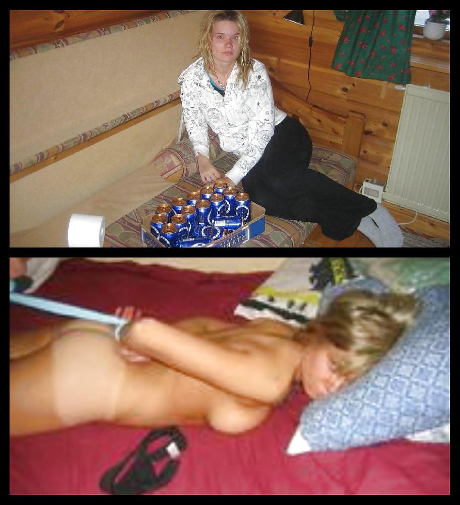 20P Before after 251 (Bondage special)