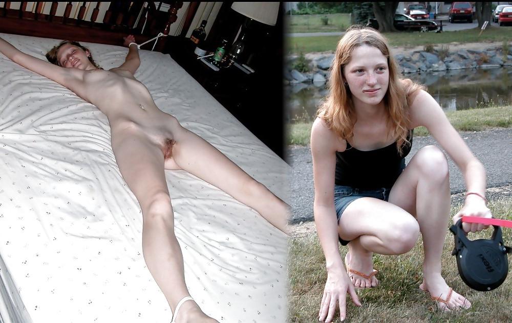 20P Before after 251 (Bondage special)