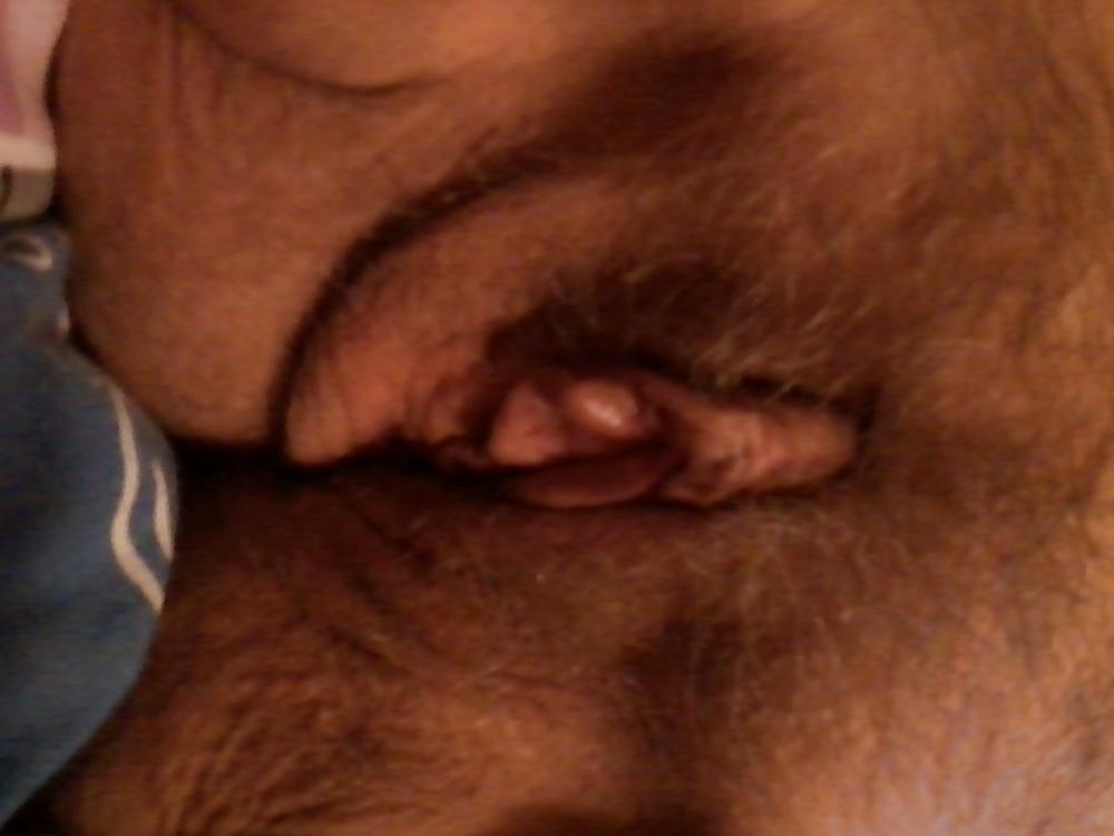5P Loose hole