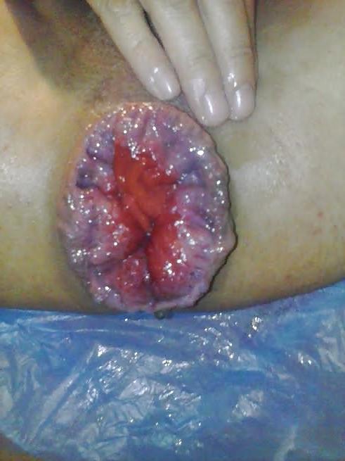 6P New pics of my gapping fuck hole