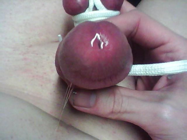 19P Some CBT i CAME across