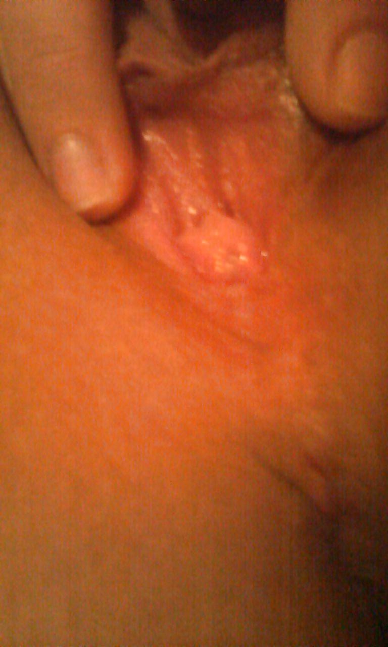 14P PRIVATE PHONE PHOTOS (HER)