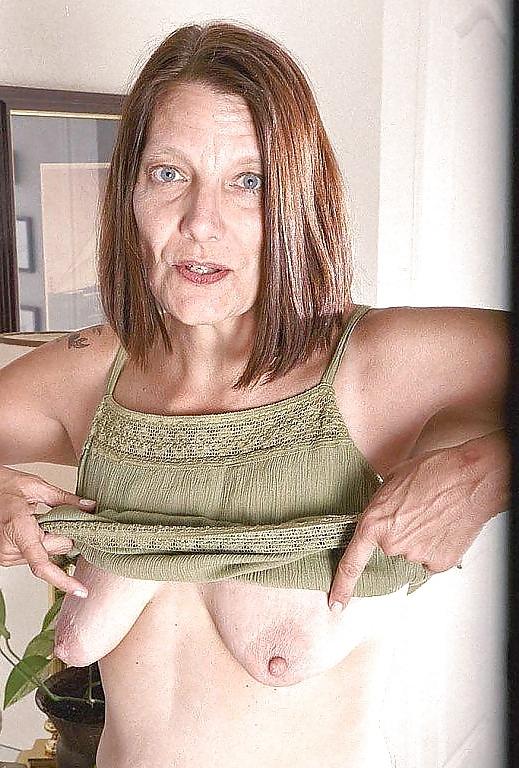 25P Stretchmarked Tits & Nipples