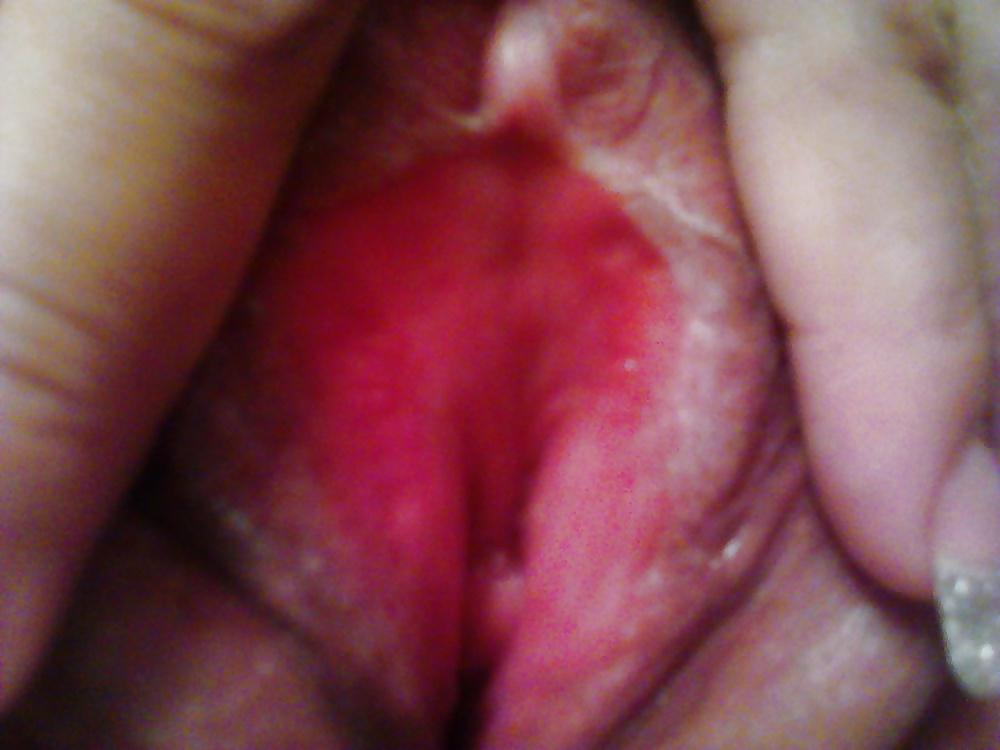 8P Beurette 