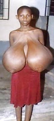 16P Abnormally big tits with huge areolas