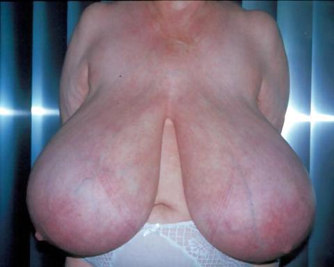 16P Abnormally big tits with huge areolas