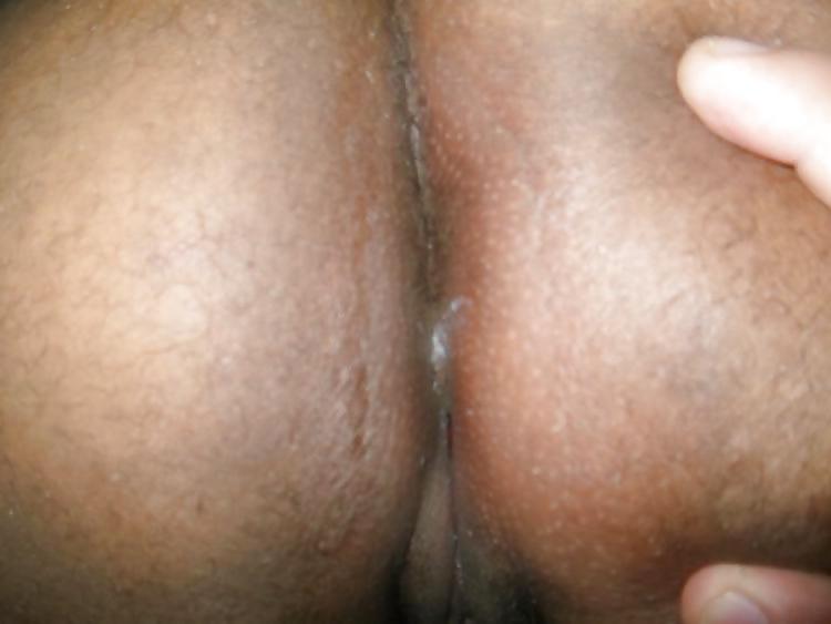 8P Ursinha Fofa