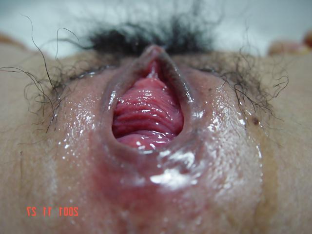 25P Asian Big Hole