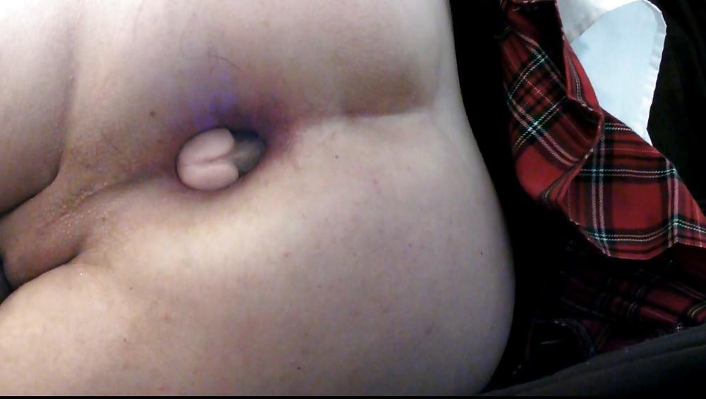 17P Kop4560000 anal gaping