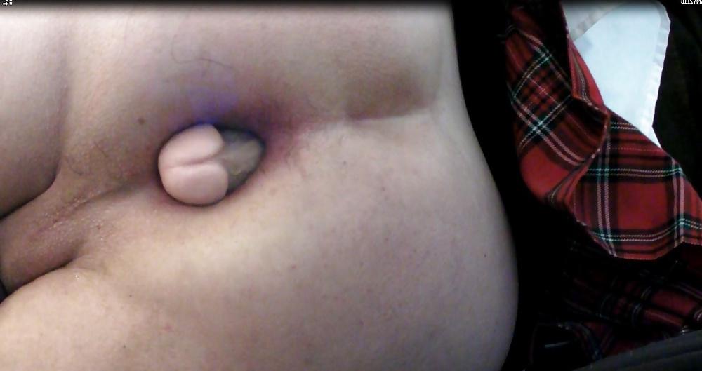 17P Kop4560000 anal gaping