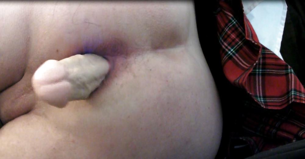 17P Kop4560000 anal gaping