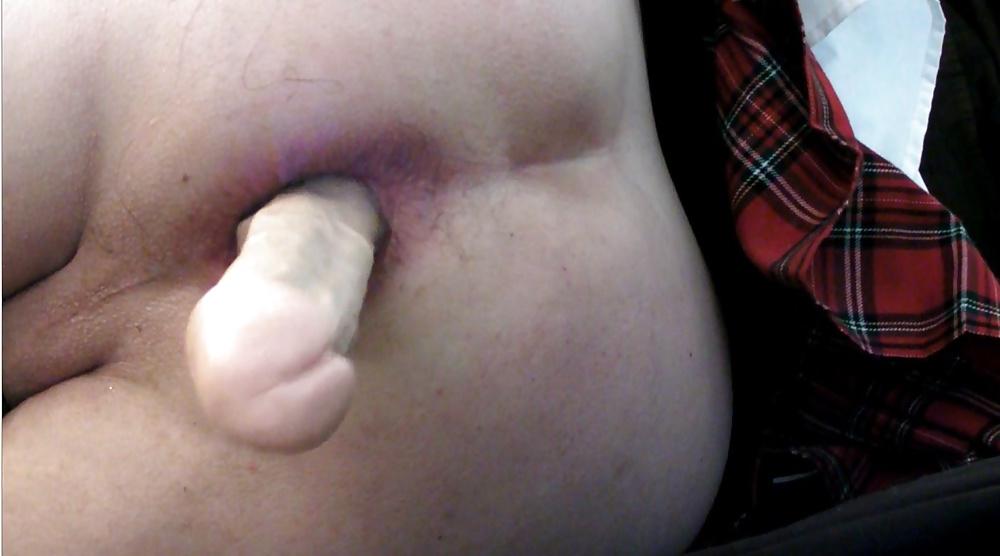 17P Kop4560000 anal gaping