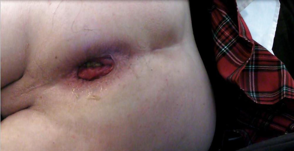 17P Kop4560000 anal gaping