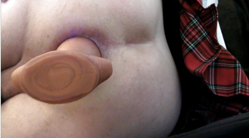 17P Kop4560000 anal gaping