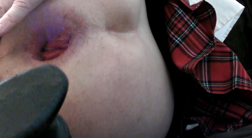 17P Kop4560000 anal gaping