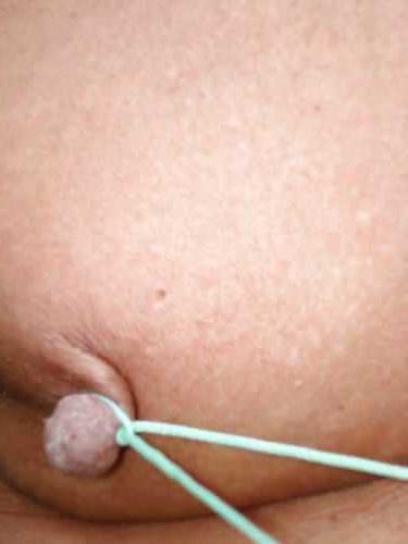 20P Breast Bondage #5