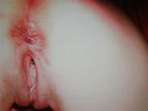 25P HOTMINX GAPING PUSSY