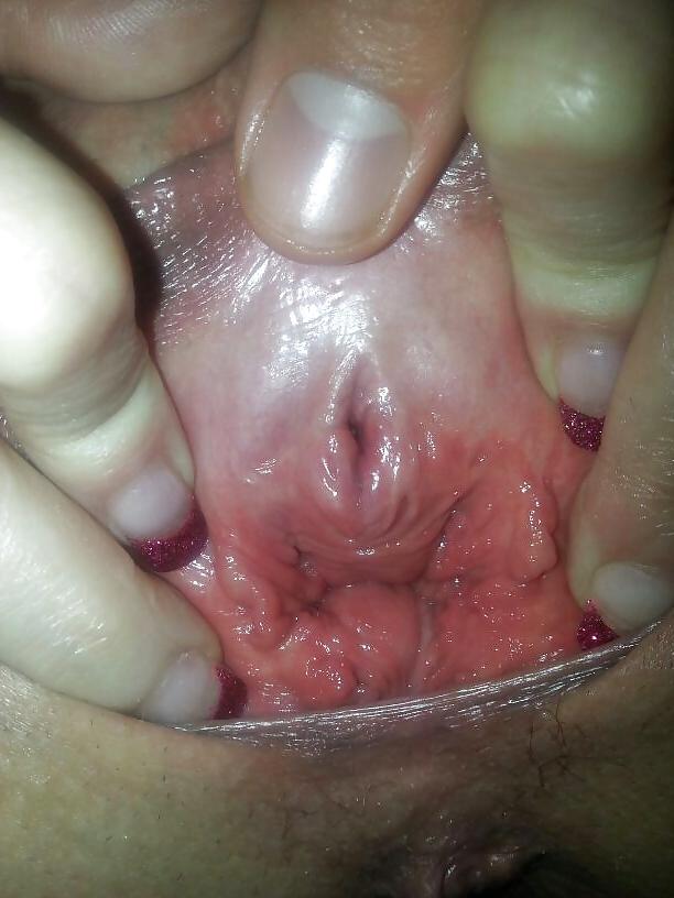 19P Hole streching
